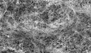 A scanning electron microscope (SEM) image of the polymer network that makes up mucins.